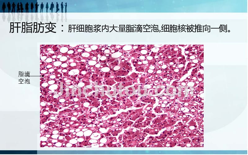 病理实验切片_附说明课件_第4页