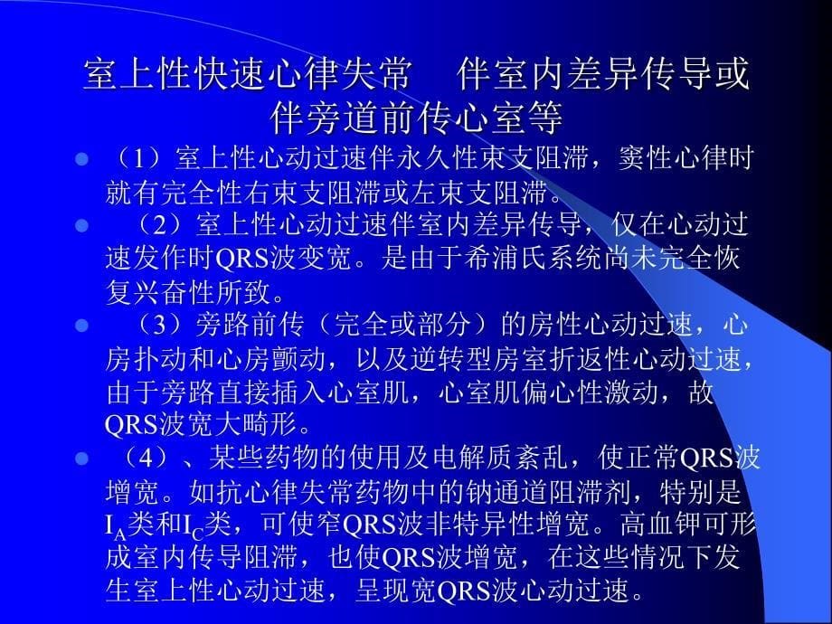 宽qrs波心动过速的课件_第5页