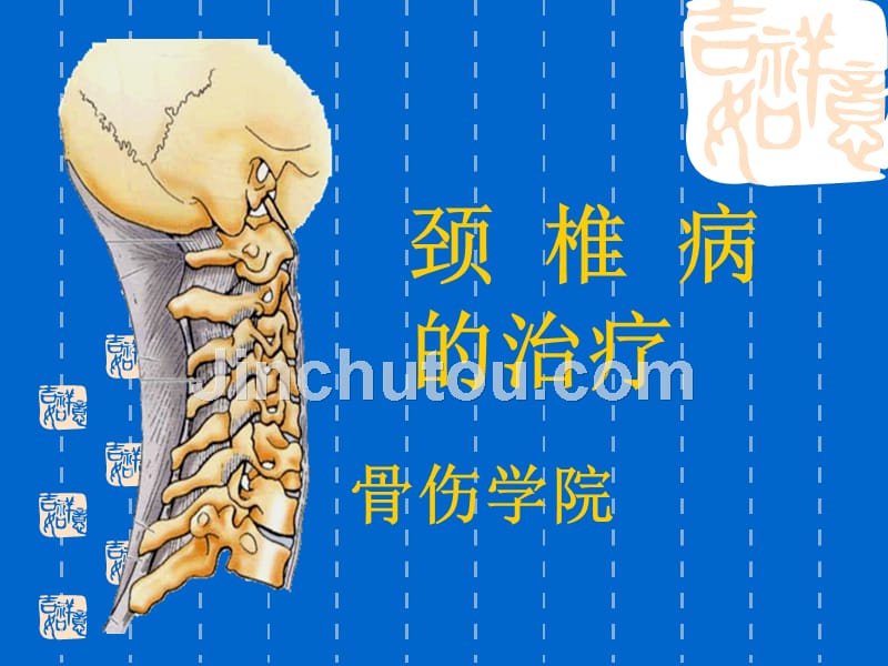 颈椎病_  ppt课件_第1页