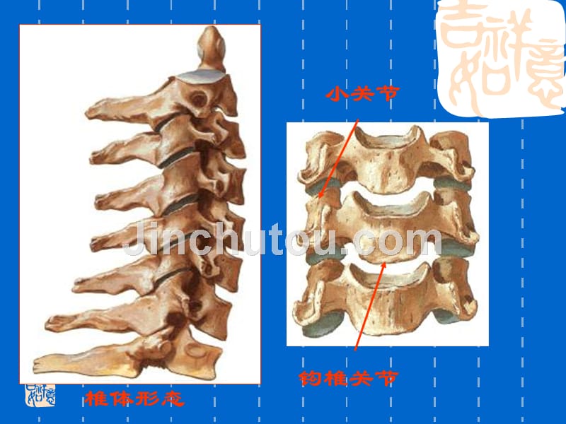 颈椎病_  ppt课件_第4页