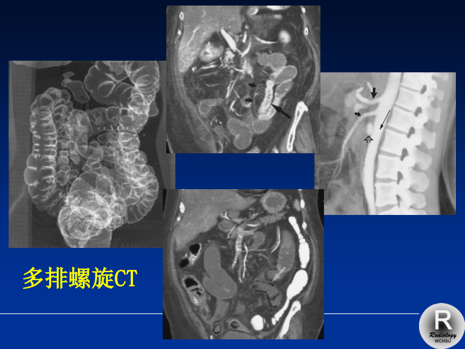 肝胆胰drwuppt课件_第4页