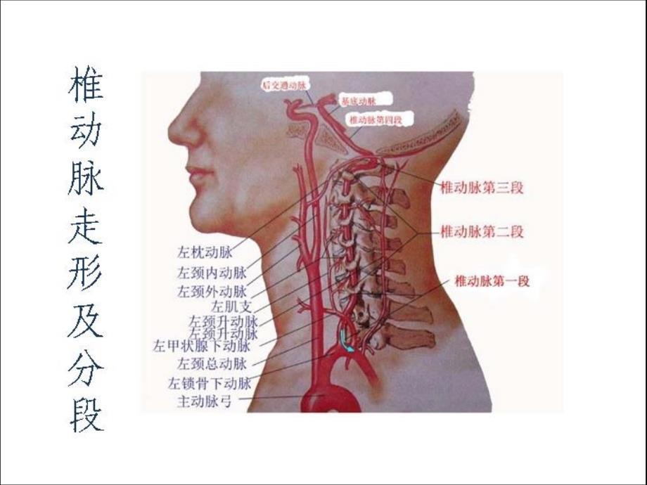 椎基底动脉闭塞综合征（读书报告）课件_第4页