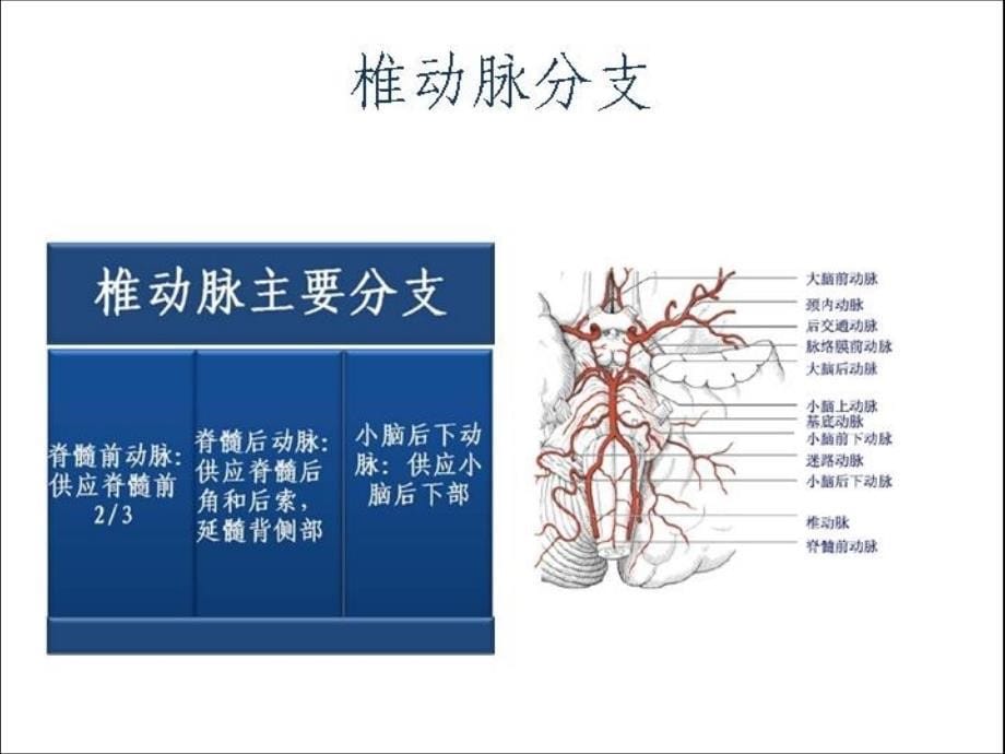 椎基底动脉闭塞综合征（读书报告）课件_第5页