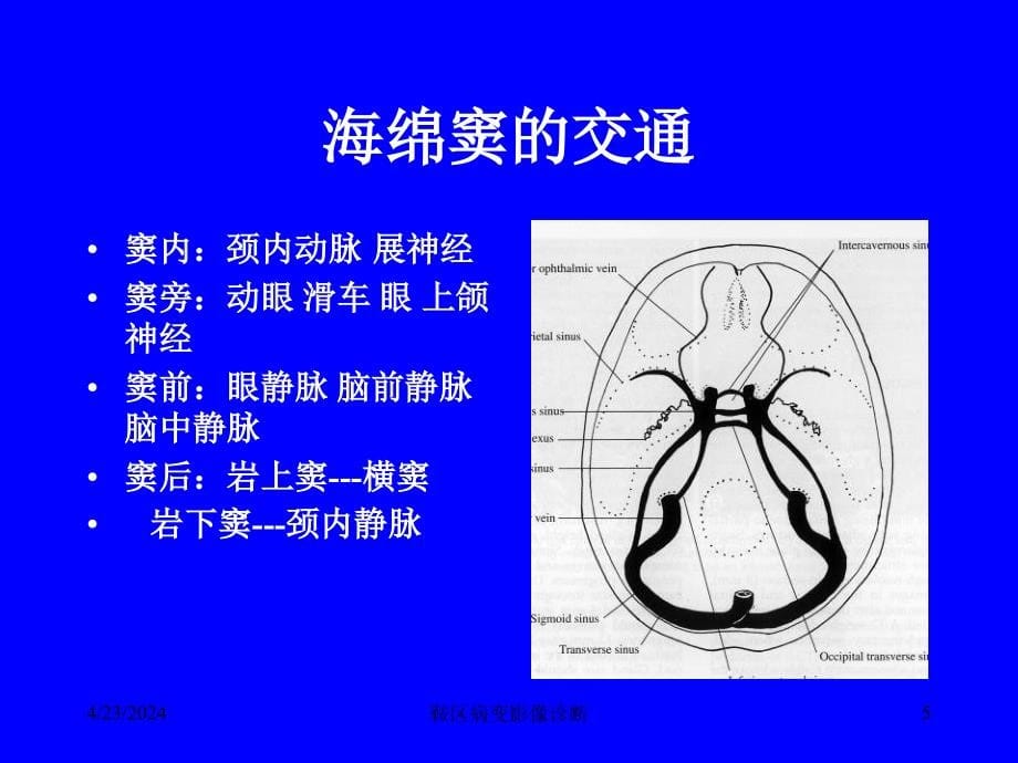 鞍区病变影像诊断ppt课件_第5页