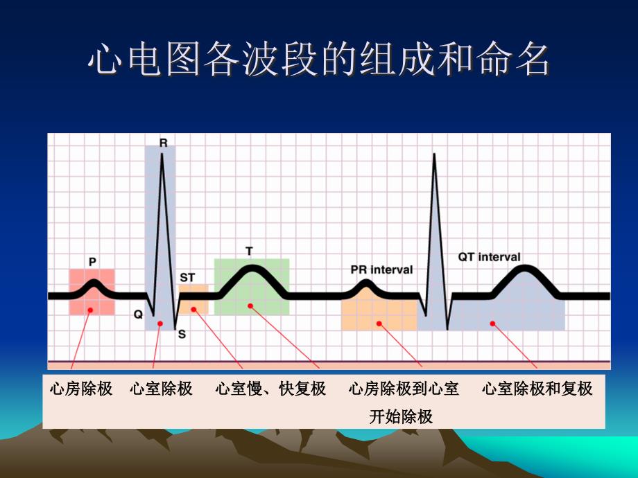 正常心电图xg课件_第4页