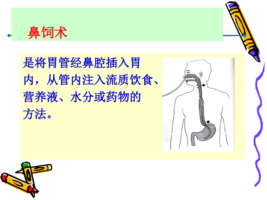 鼻饲术ppt课件_第2页