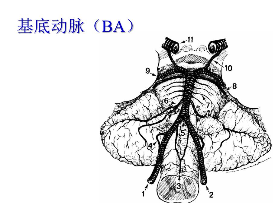 椎基底动脉卒中诊治_ppt课件_第4页