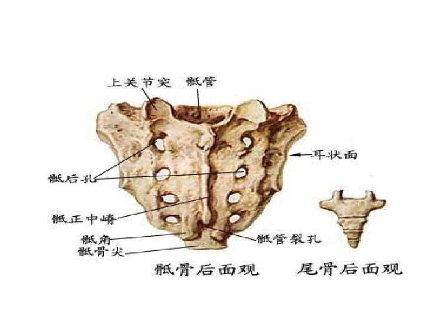 骶髂关节炎海南医学院20131ppt课件_第5页