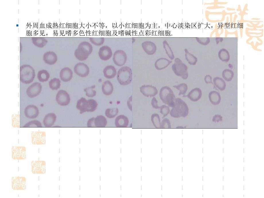 骨髓细胞形态学教学ppt课件_第5页