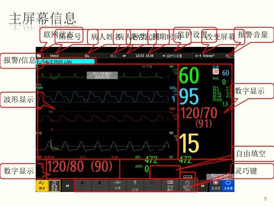 飞利浦监护仪m60ppt课件_第5页