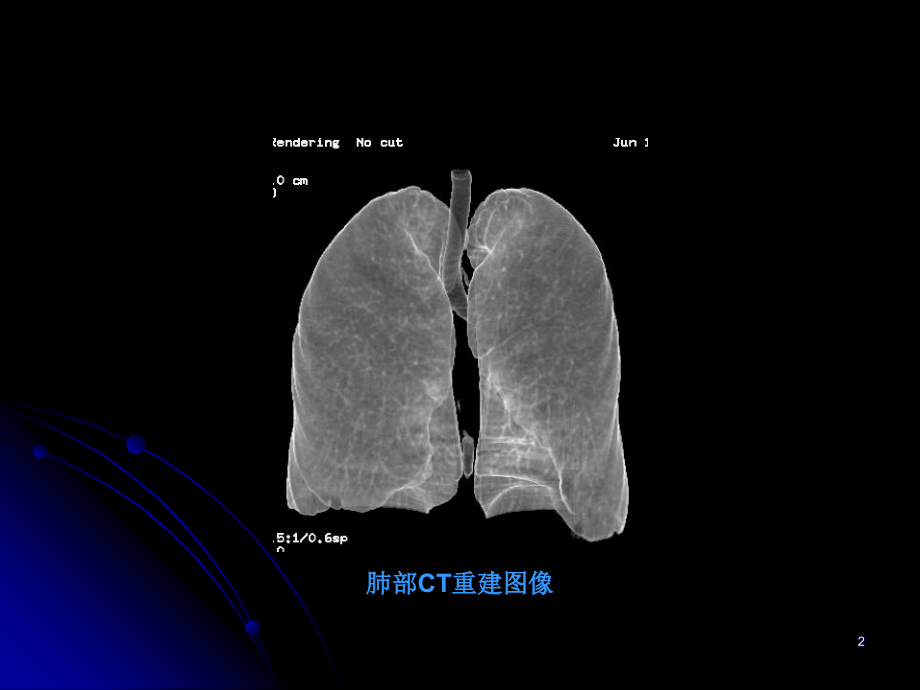 呼吸系统影像学诊断ppt课件_第2页