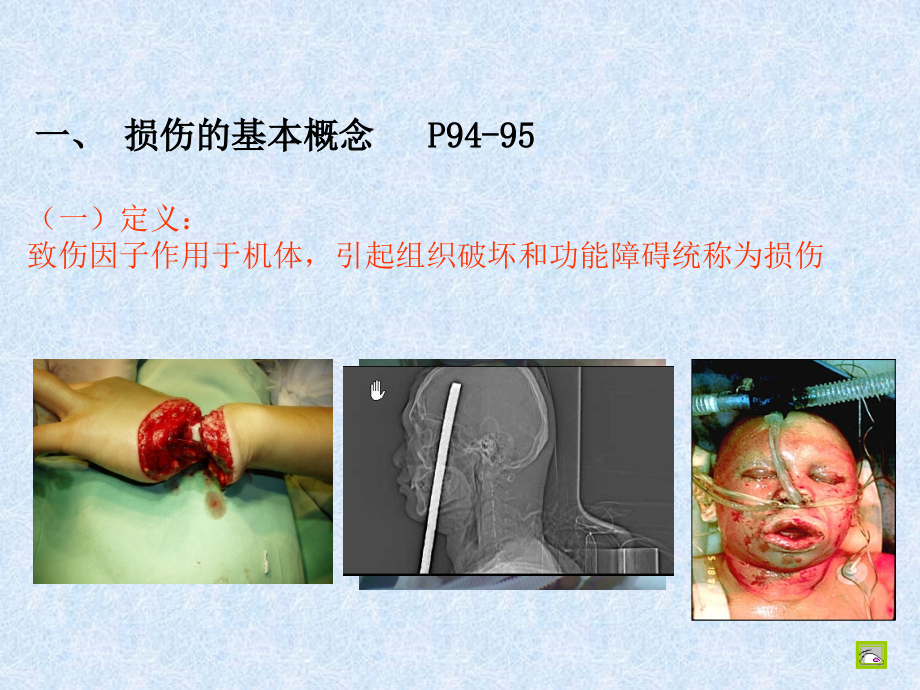 临床医学损伤性疾病幻灯片_第4页