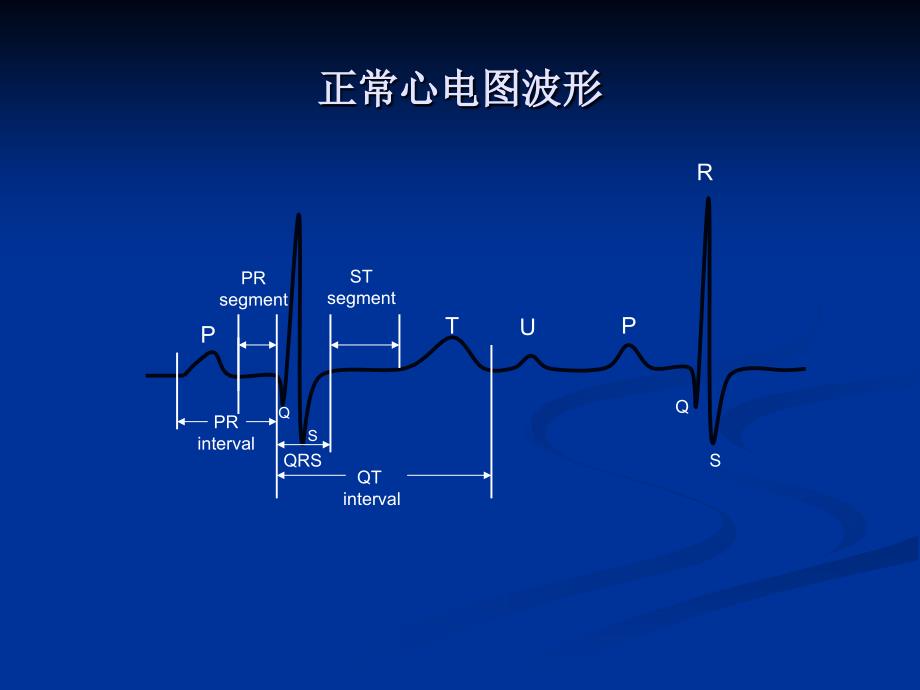 心电图基础_2011 南中医讲课_第4页