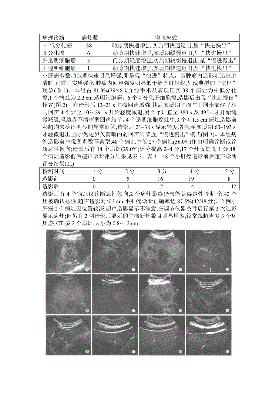 超声论文_第3页