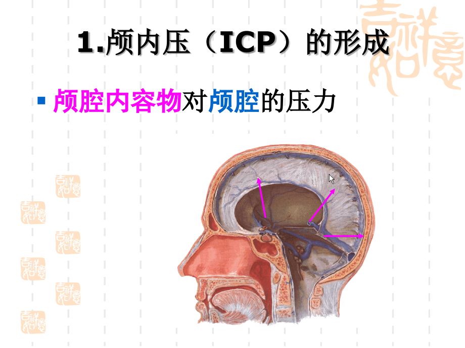 颅脑疾病病人的护理1课件_第4页