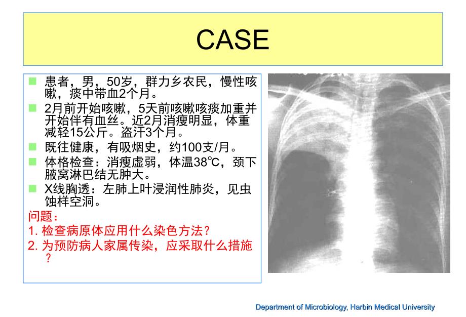 结核课件-分枝杆菌属.ppt_第4页