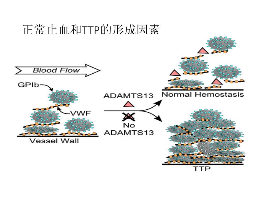 血栓性血小板减少性紫癜 ppt课件_第4页