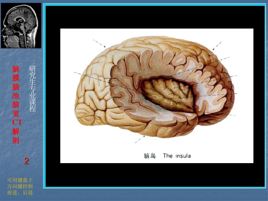 颅脑断层解剖课件_第2页