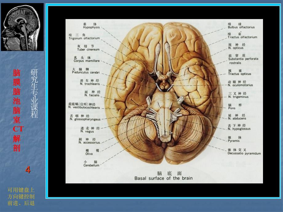 颅脑断层解剖课件_第4页