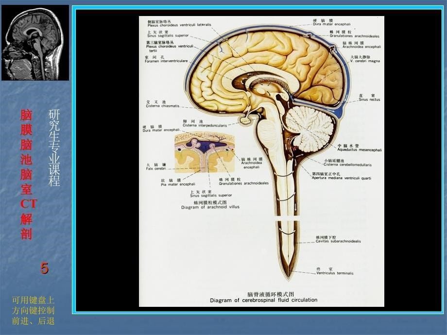 颅脑断层解剖课件_第5页