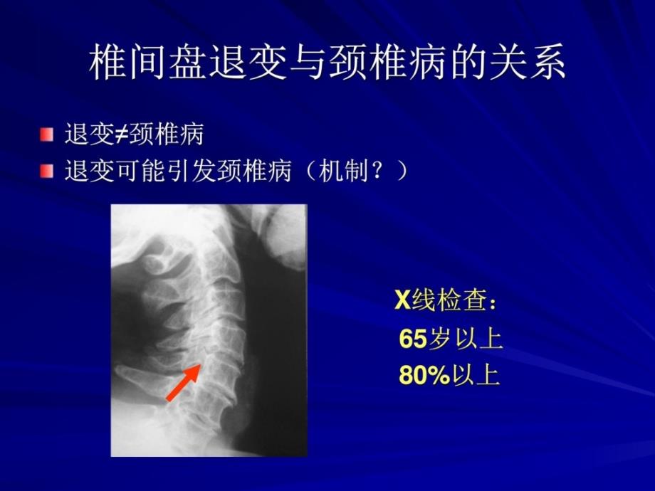 [宝典]椎间盘退变与颈椎病课件_第4页