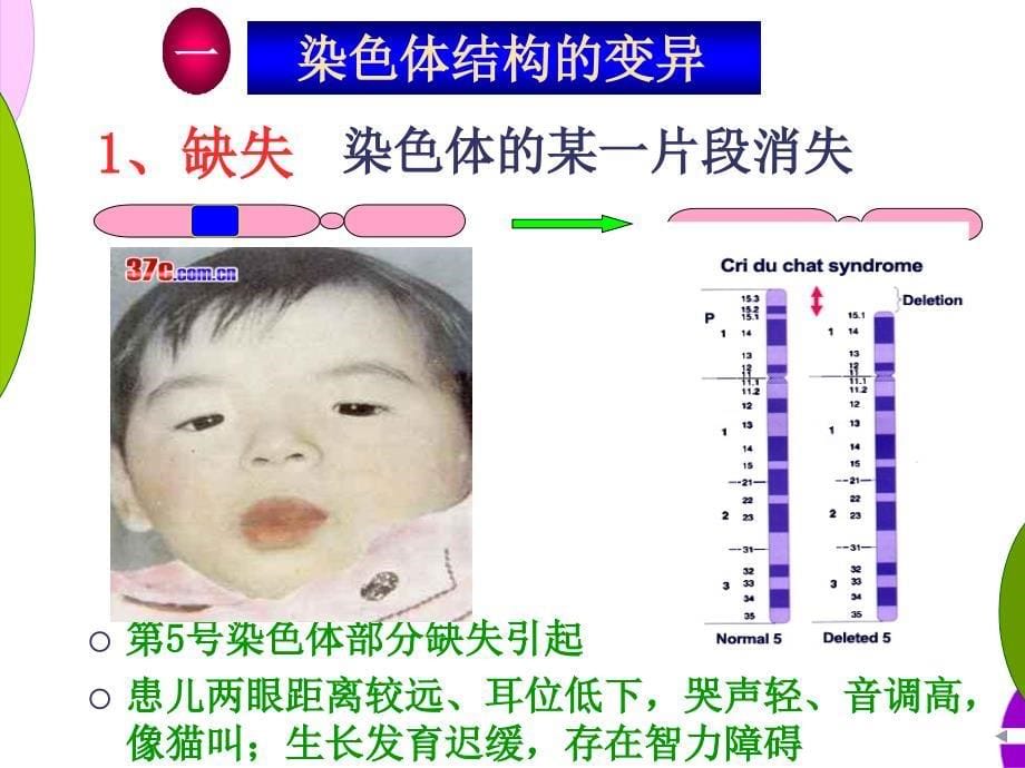 【医学ppt课件】染色体变异_第5页