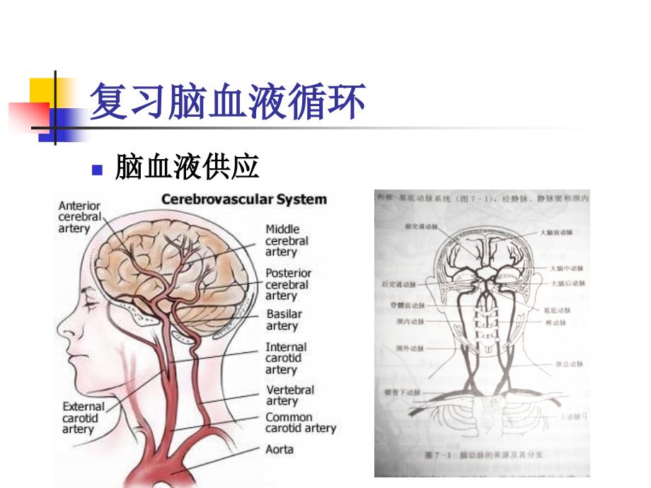 脑血管疾病cerebrovascular disease （ cvd ）课件_第4页