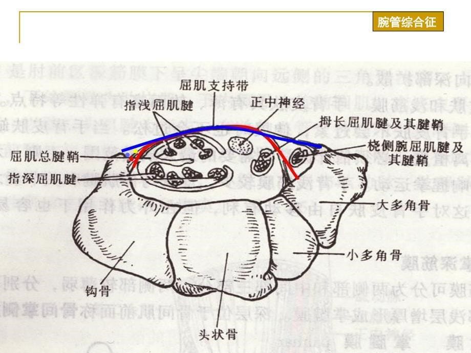 腕管综合症ppt幻灯片课件_第5页