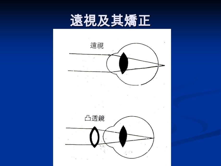 【医学ppt课件】視力保健講座_第5页