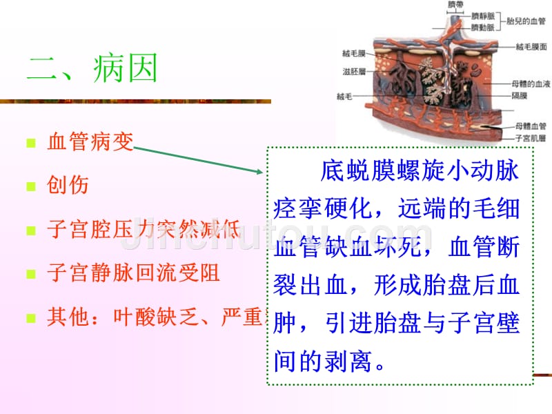 胎盘早剥的护理课件_第5页