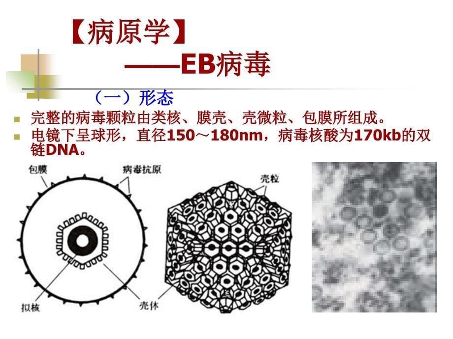 医学文库网-传染性单核细胞增多症 西安交通大学传染病学教学课件ppt课件_第5页