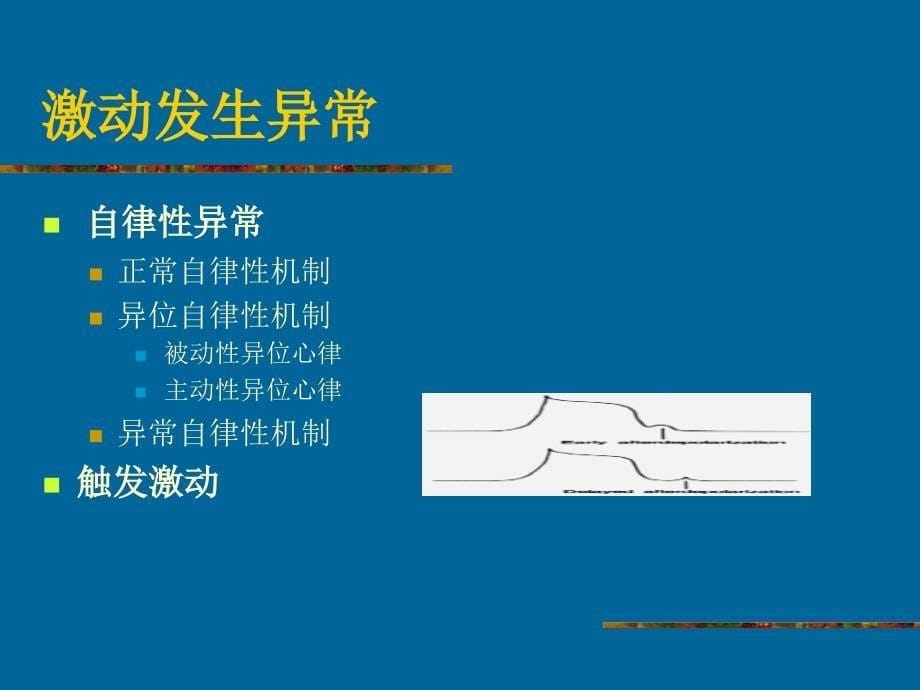 常见心律失常的药物治疗ppt课件.ppt_第5页