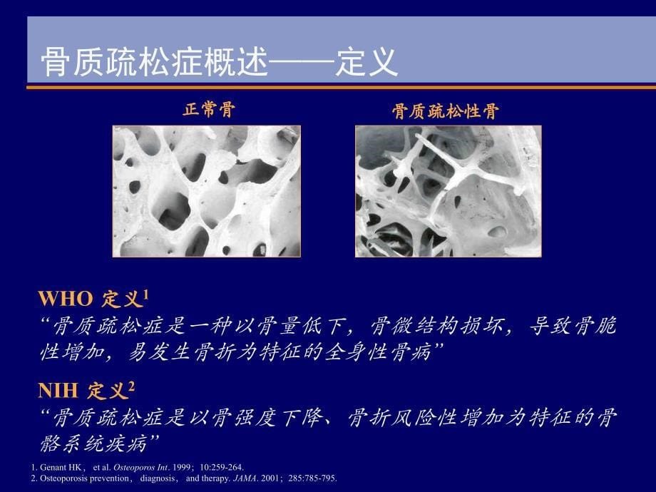 原发性骨质疏松防治规范ppt课件_第5页