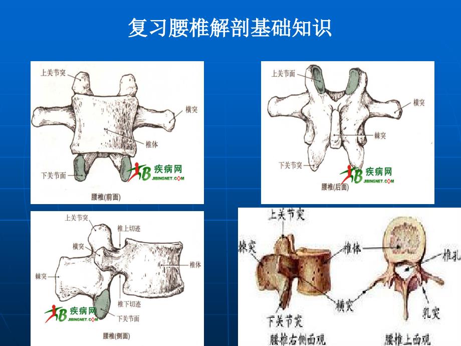 微创椎间盘突出微创疗法课件_第2页