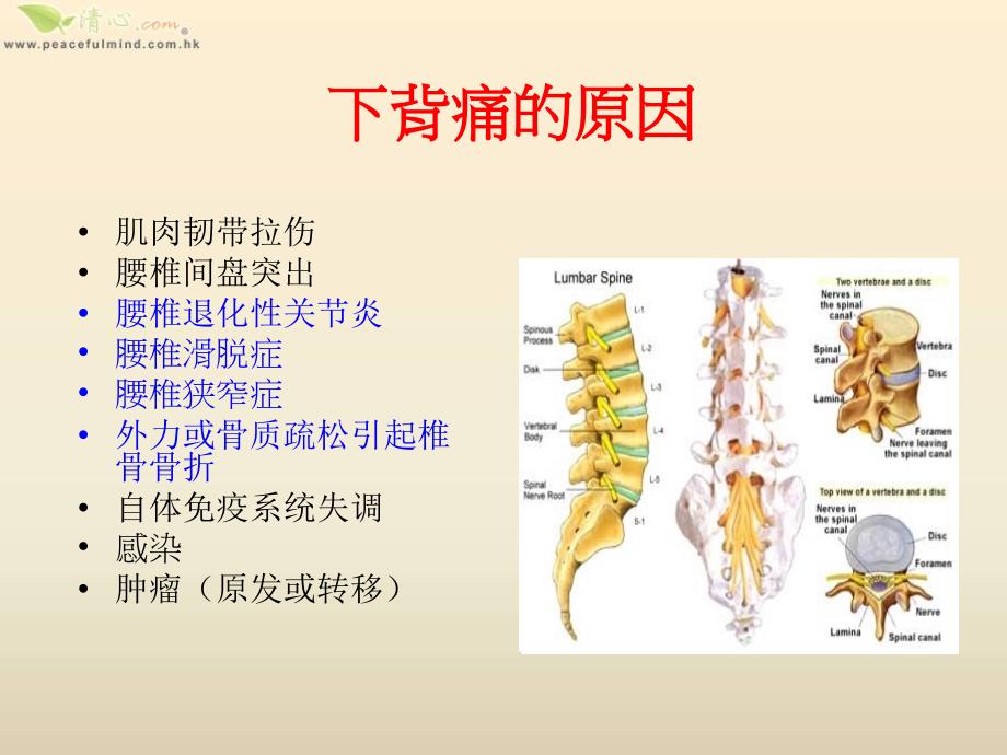 中老年人常见的骨关节问题与保健之道课件_第2页