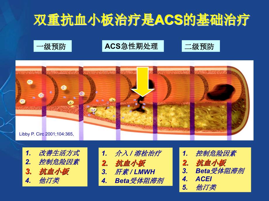 患者的抗血小板治疗_第4页