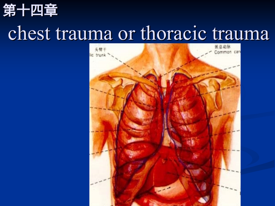 第十四章胸部疾病病人的护理讲课 ppt课件_第4页