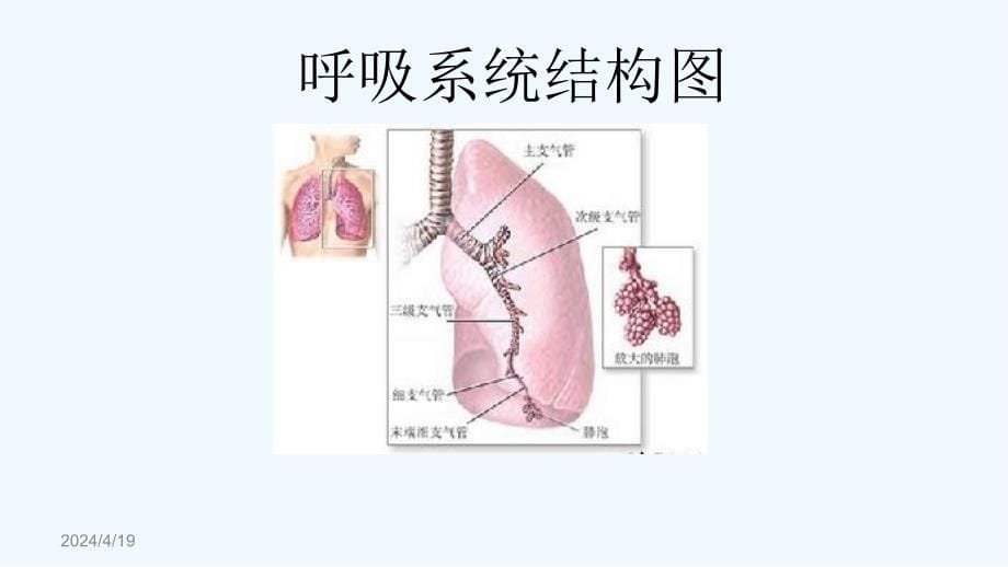 肺炎的护理ppt课件_1_第5页