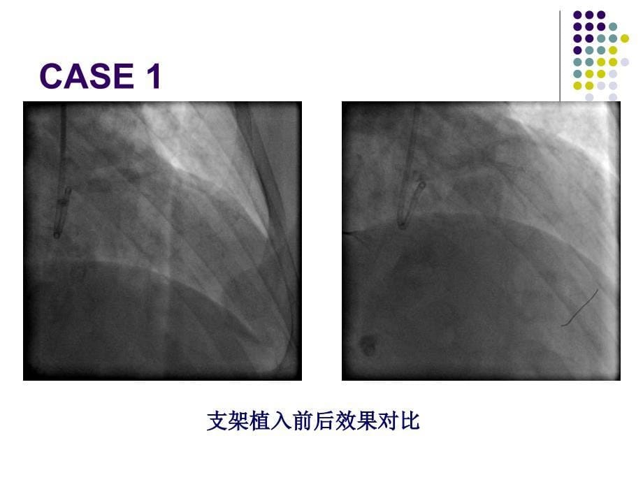 旋磨病历姜铁民_第5页