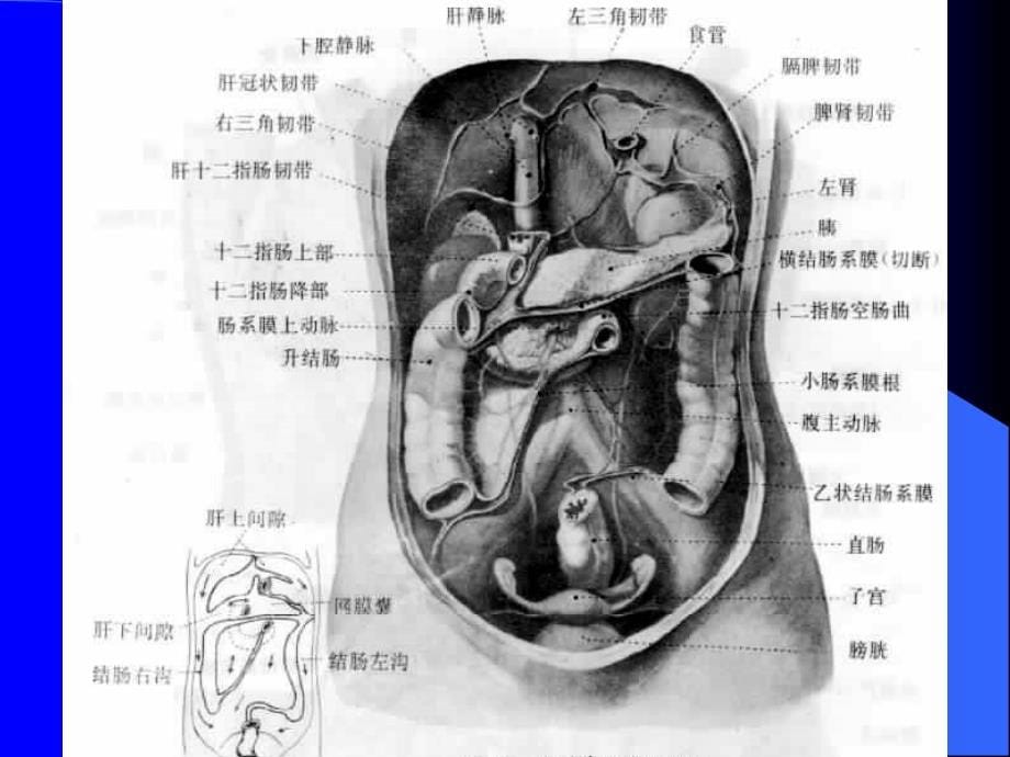 腹腔及腹膜后ct诊断1讲述课件_第5页