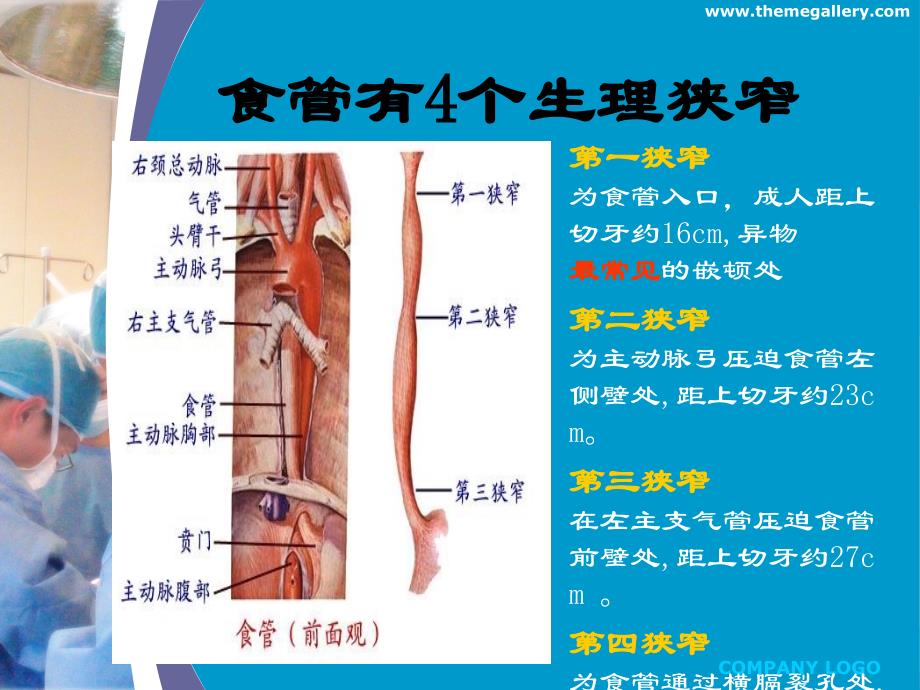 食管异物ppt课件_第4页