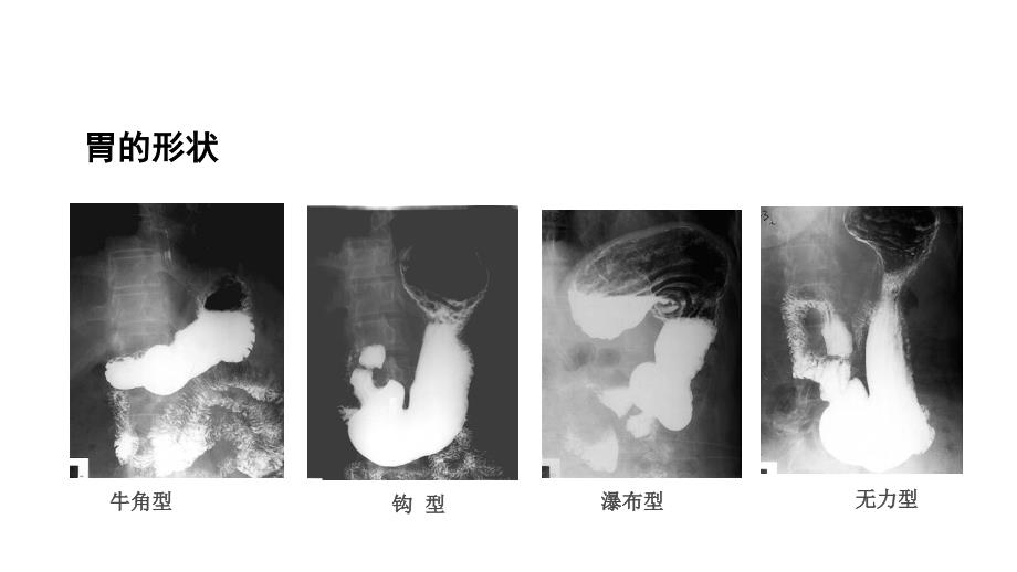 x线检查与诊断技术医学ppt_第2页