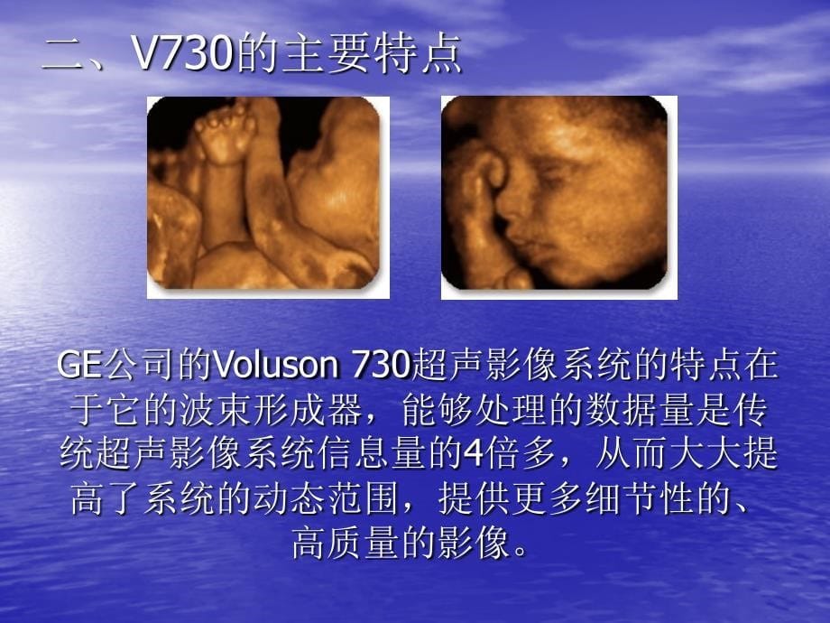 voluson 730初级培训 ppt课件_1_第5页