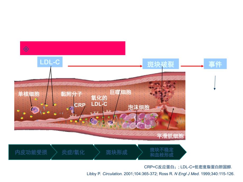 脑血栓形成ppt课件_第3页