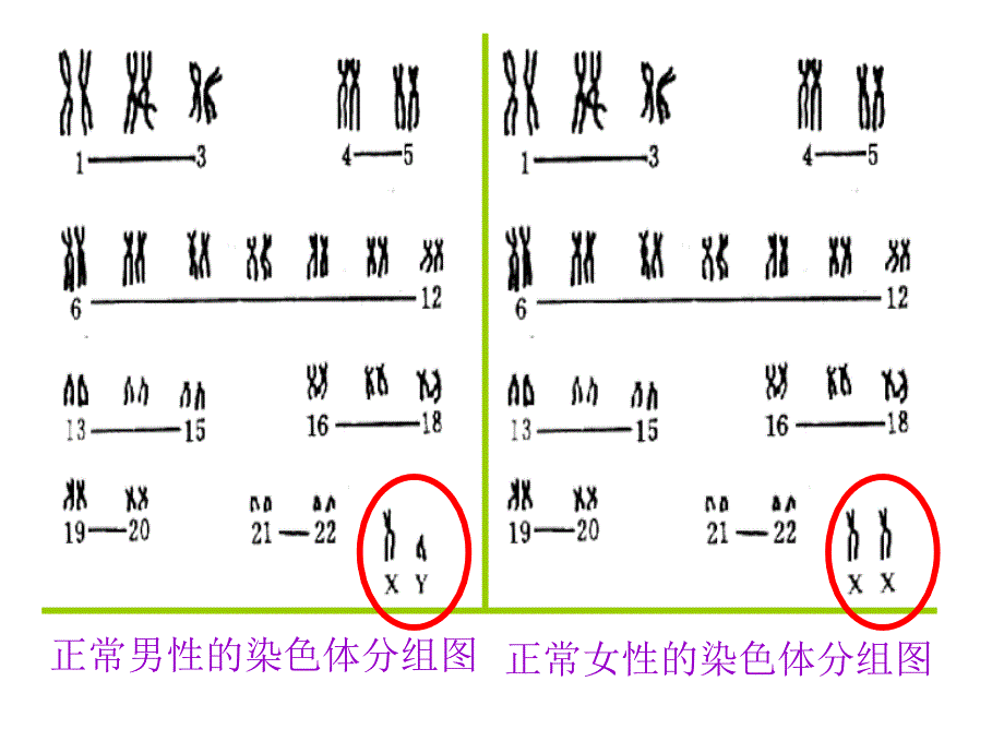 伴性遗传 ppt课件_第3页