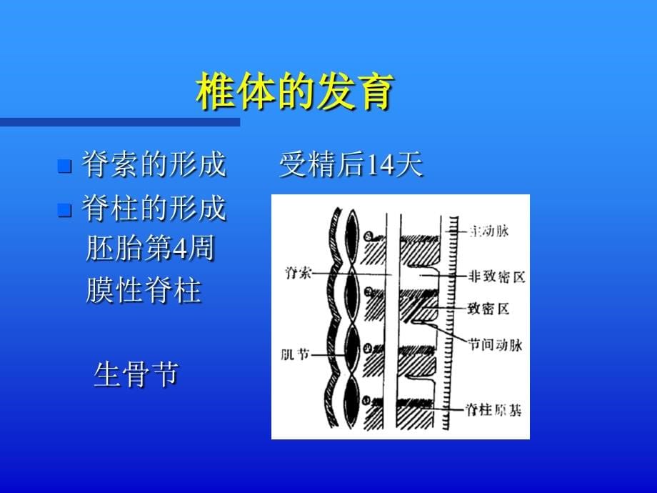 椎间盘突出的影像学诊断最新ppt课件_第5页