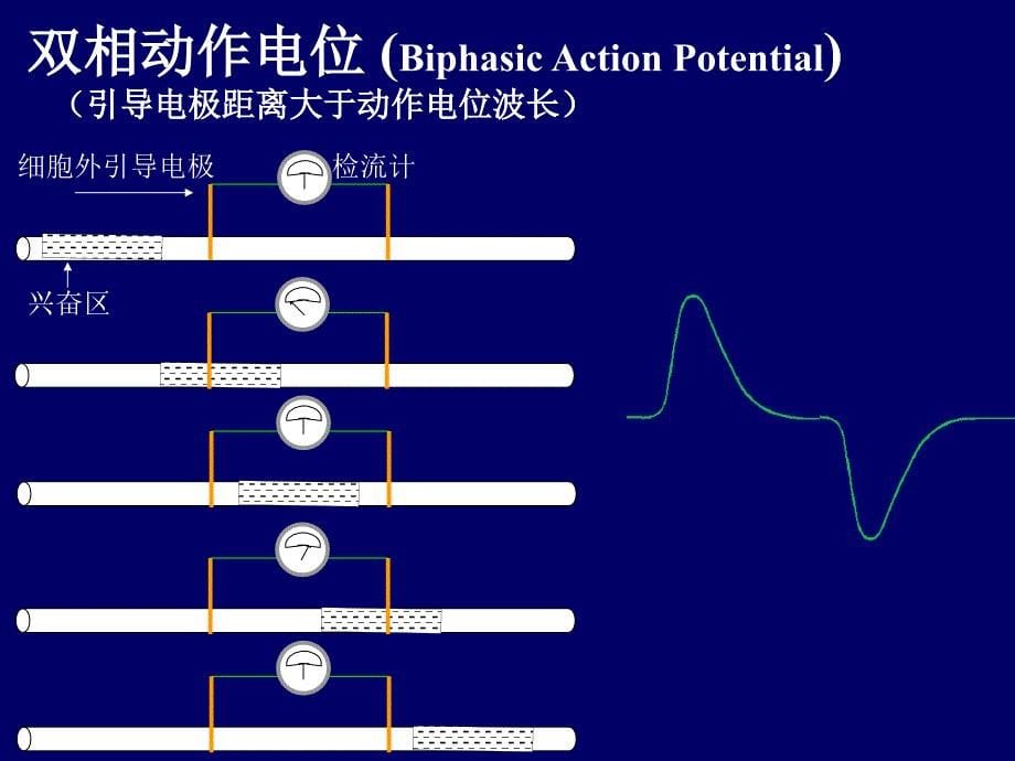 坐骨神经干课件_第5页