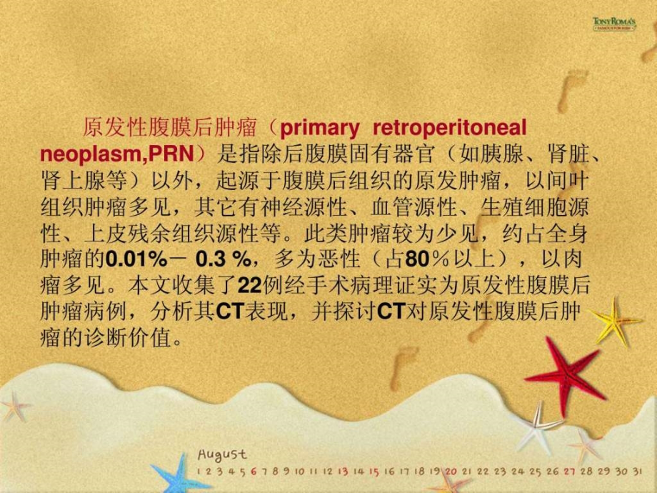 腹膜后肿瘤的ct诊断图文课件_第2页