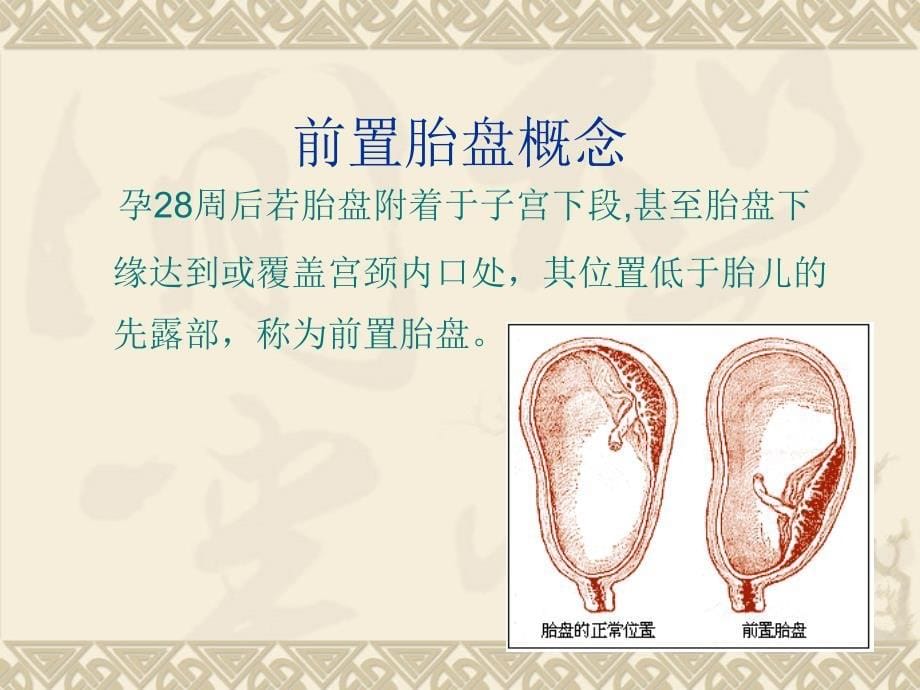 医学课件大全妊娠晚期出血性疾病的护理_第5页