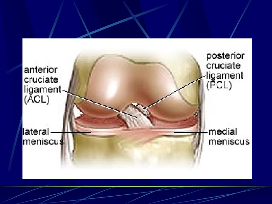 膝关节幻灯课件_第4页